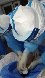 孕妇确诊新冠肺炎，母婴风险大么？