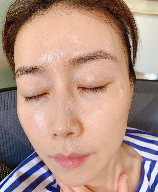 脸上闭口粉刺怎么消除,脸上闭口粉刺怎么办