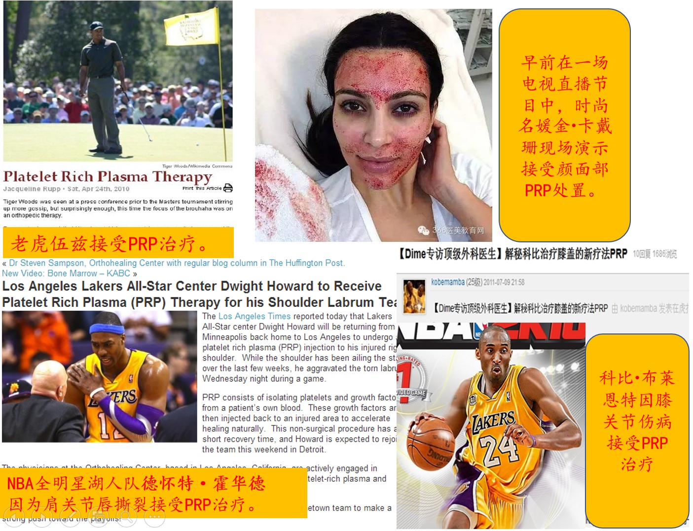 PRP治疗术——超级巨星也选择的的自体组织再生疗法