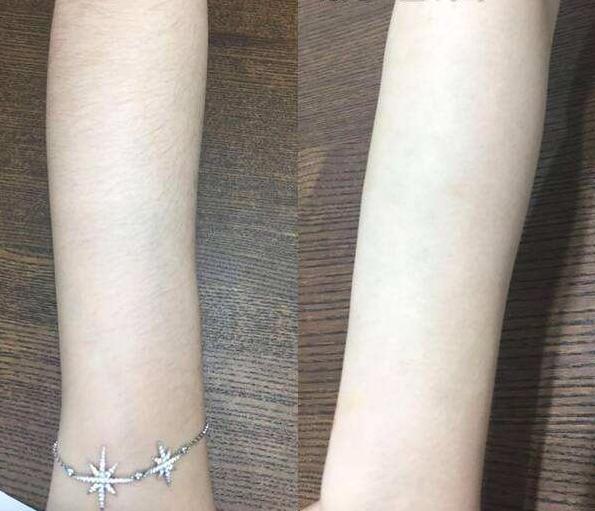 身体乳会促进腿毛的生长吗,为什么身体乳用多了会长腿毛