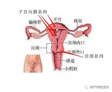 子宫息肉手术要多久,子宫息肉影响月经吗