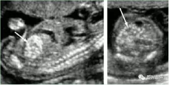 产科常规彩色超声报告单介绍,常见妇科疾病超声报告