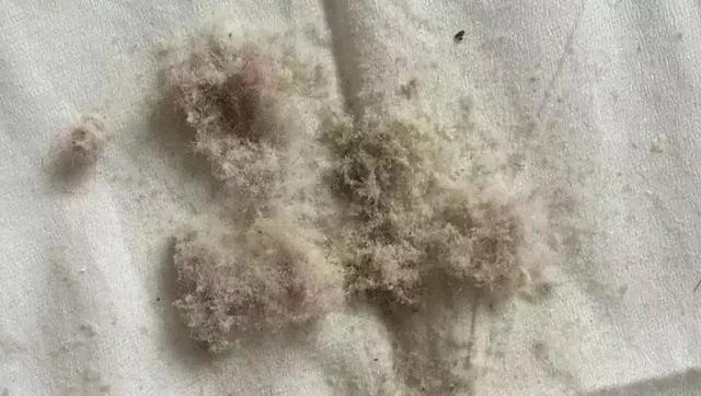 床上螨虫成窝，家里老人小孩老过敏，教你1个土法子，让螨虫消失
