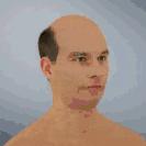 30岁脱发的男人正常吗,20岁男脱发有救吗