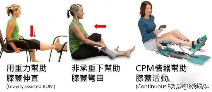 带你了解「半月板损伤术后康复」四个阶段