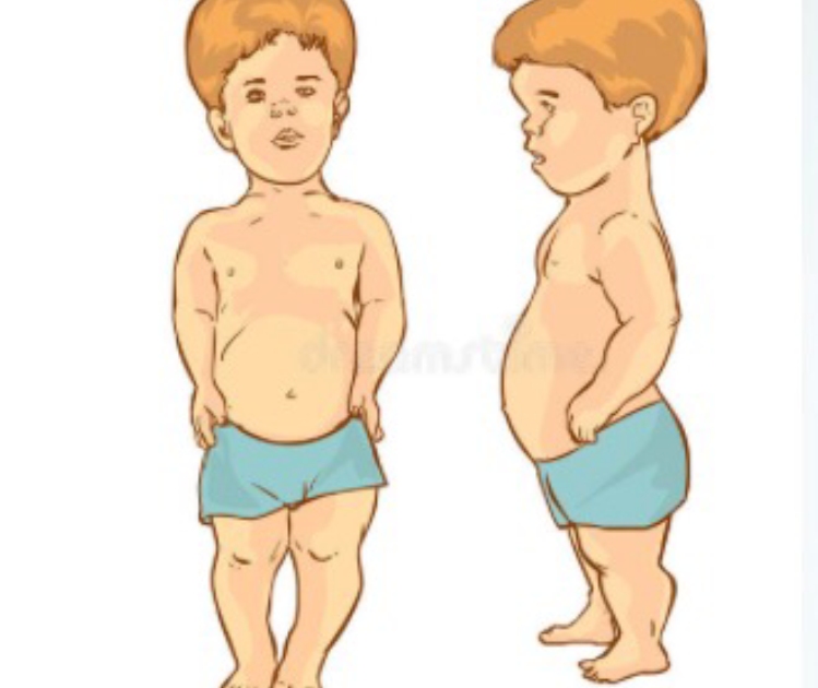 矮小症，我拿什么拯救你！（一）原因篇