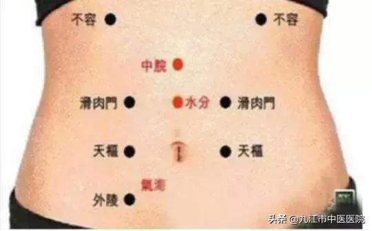 针灸减肥效果好吗大概需要多少钱,针灸埋线减肥是通过什么原理减肥