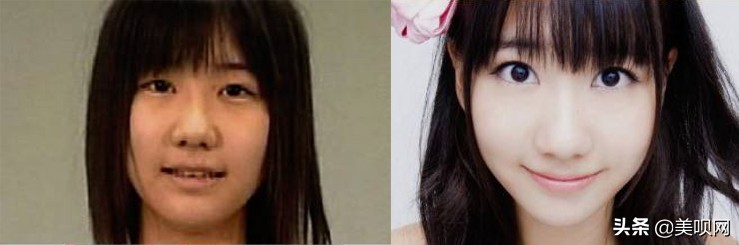 森绘梨佳日本采访,森绘梨佳颜值分析