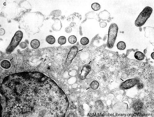 科普向——战“疫”进行时！三分钟看完世界病毒发现史！