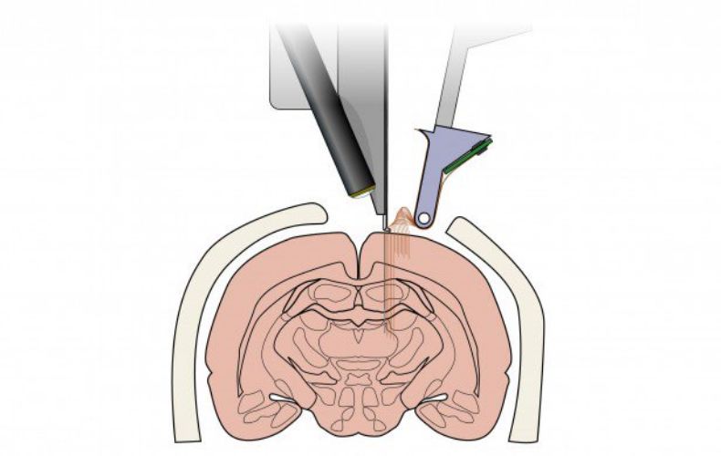 夸大其辞？马斯克最新发布的脑机接口系统有多疯狂