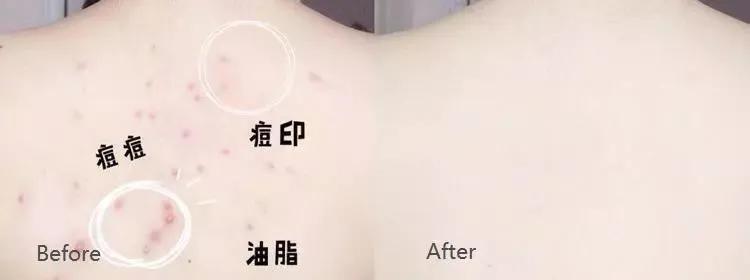 日本变态搓澡巾又来了！轻松搓泥如下雨，网友：20年的澡白洗了