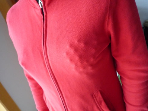 如何预防乳腺增生的最好方法,详解乳腺增生的预防方法