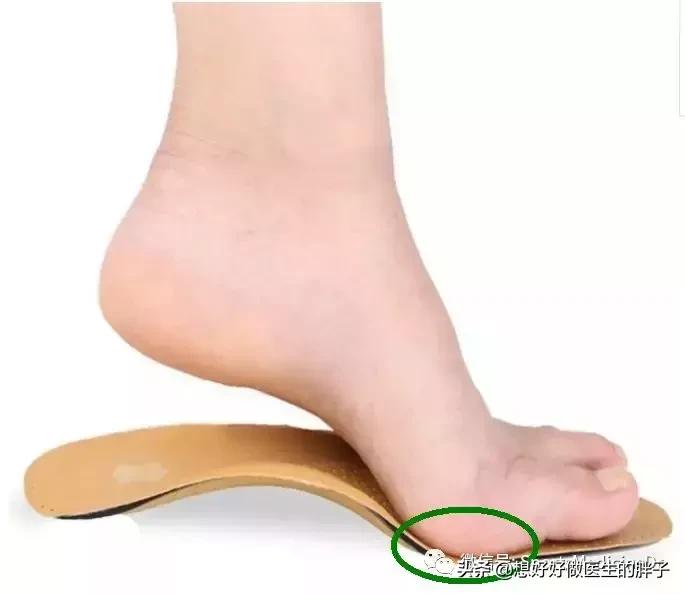 一个方法解决足跟痛,什么方法缓解足跟痛