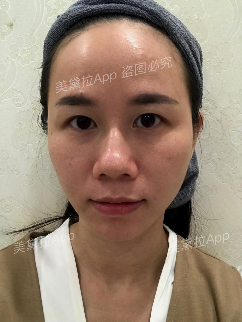 补水保湿美白蛋白精华,美白补水抗皱紧致胶原蛋白