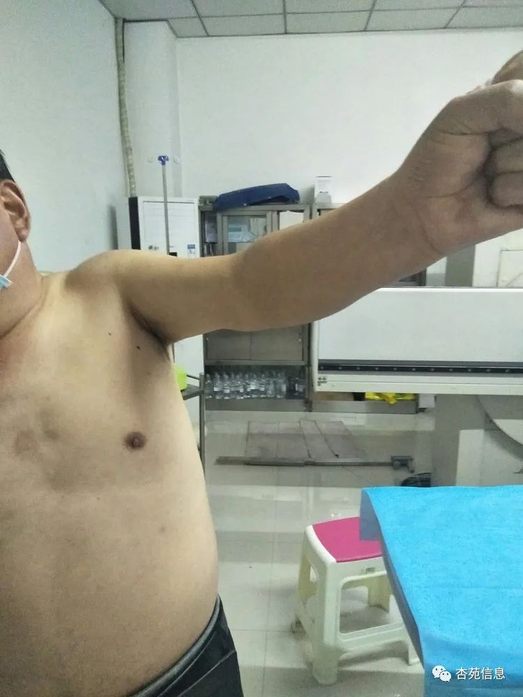 介入治疗加中医治疗,疼痛介入治疗的方法有几种