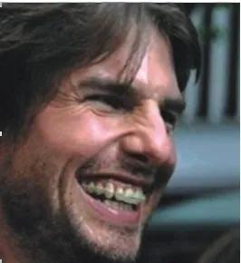 你与颜值和健康之间只差一个牙套,你与颜值巅峰只差一个发际线