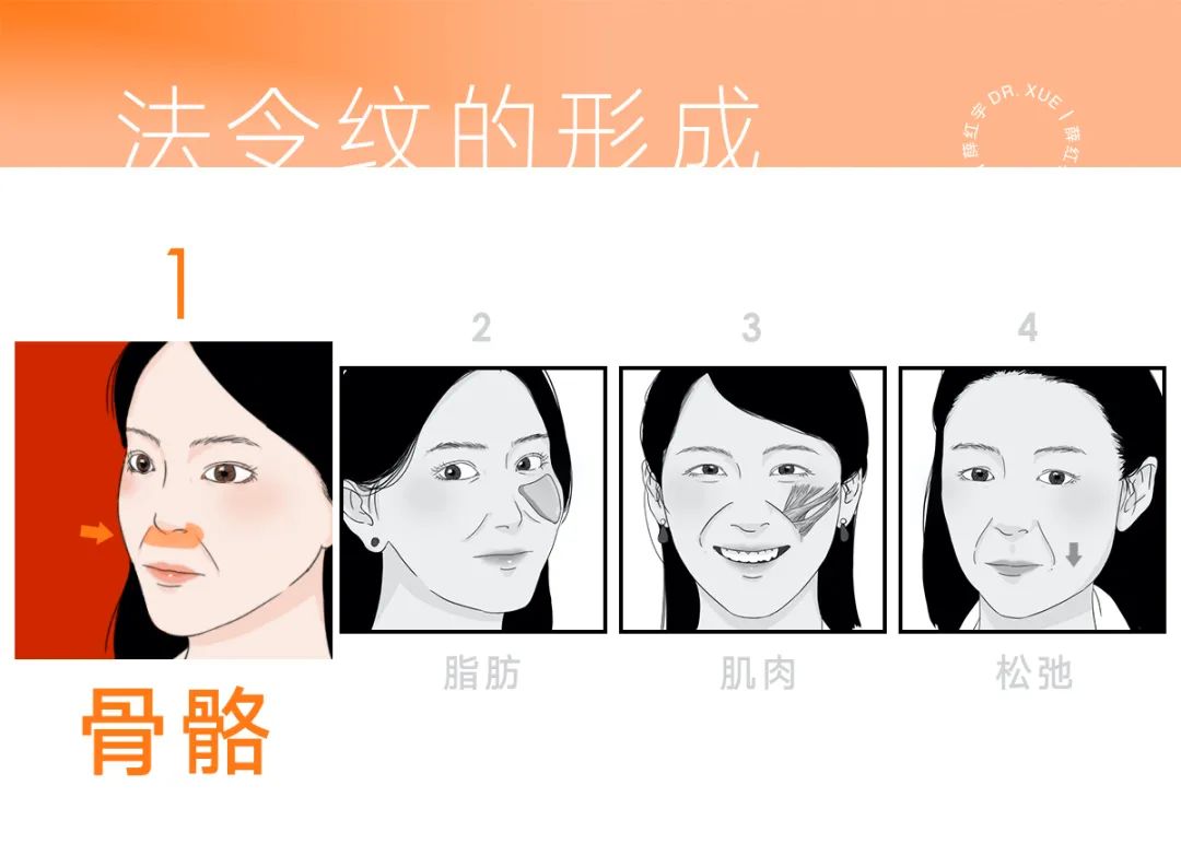 脾胃好了法令纹会改善吗,面部瑜伽能改善法令纹吗