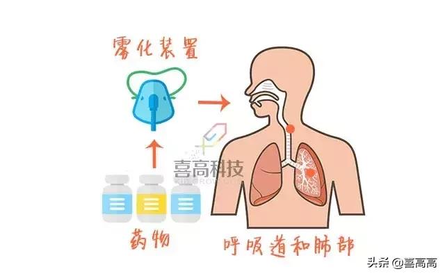 雾化药有止咳化痰的吗,不含激素的止咳雾化药