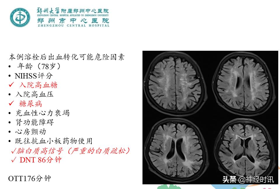 静脉溶栓怎么引起的,静脉相关并发症的预防及处理