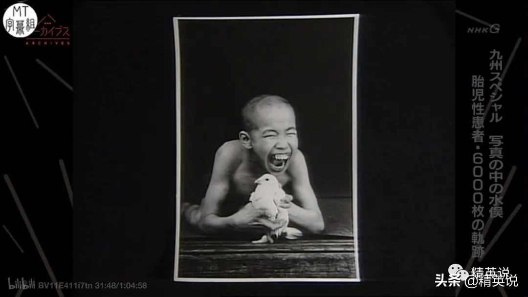 60多年前日本万人中毒成世界公害！如今福岛百万吨核废水入海…