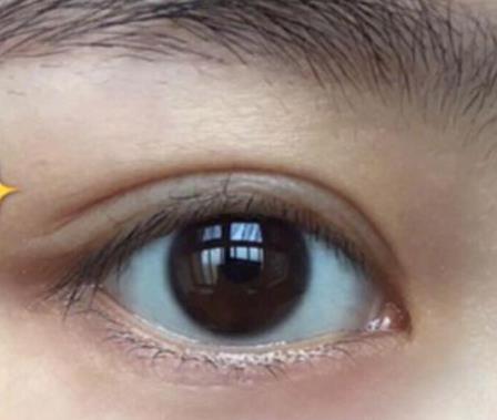 网上卖的去眼袋的眼霜真的有效吗,三分钟祛眼袋的眼霜产品是真的吗