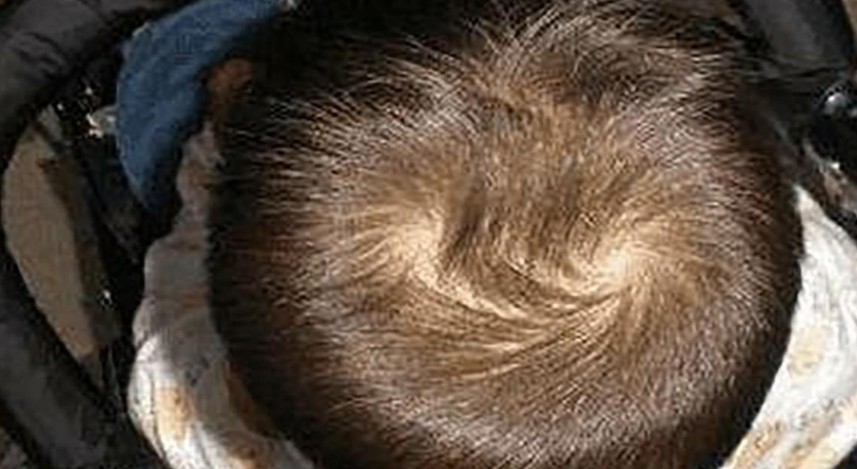 “双旋男孩找不到,双旋女孩没人要”,关于头上的旋,这几点要懂