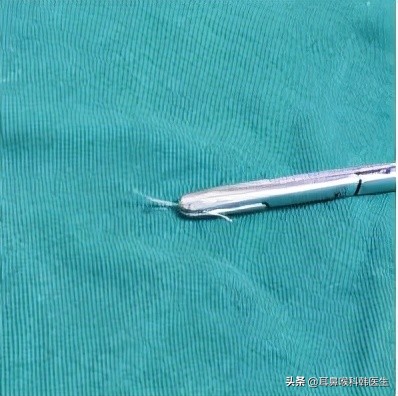 为啥来院就做内镜检查？医生怕是在骗我钱吧