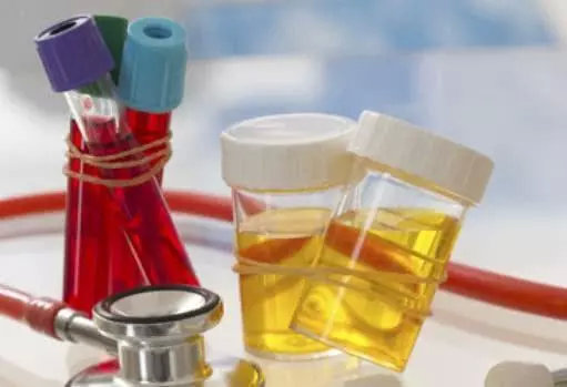 年轻小伙尿潜血是什么原因引起的,长期尿潜血可怕吗