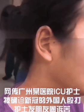 插队骂人撕咬护士,护士遭插队辱骂