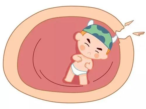刚刚生出来的宝宝奇怪现象,妈妈生下孩子后难产大出血