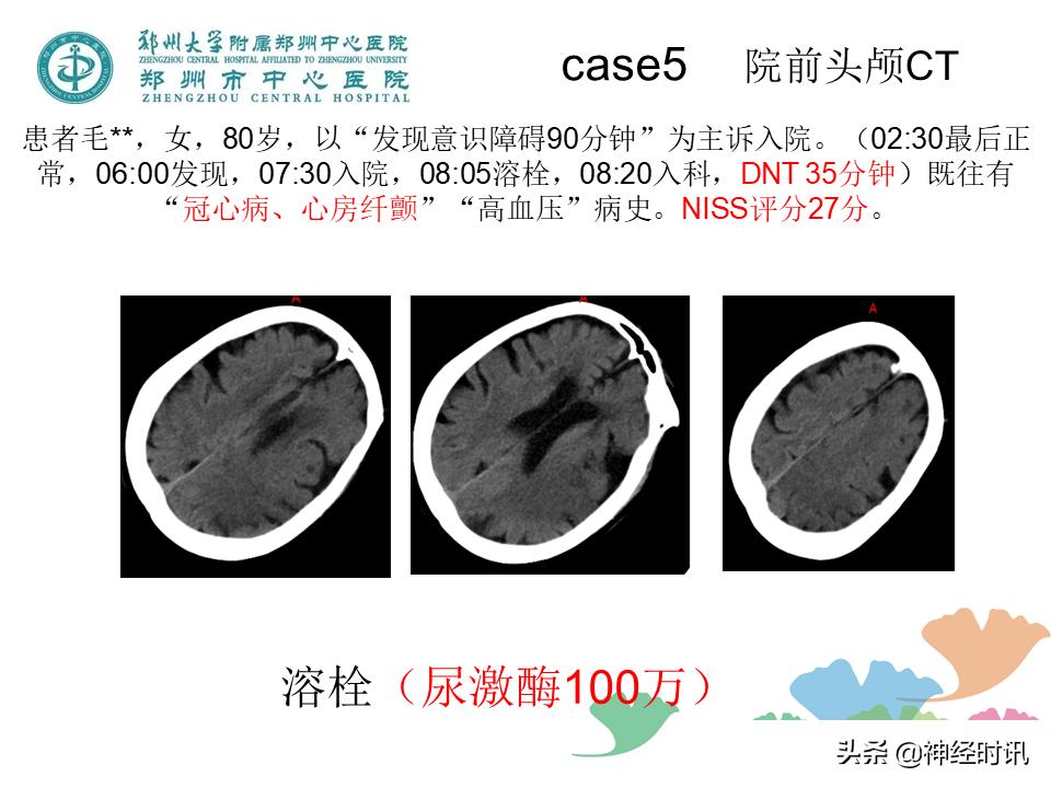 静脉溶栓怎么引起的,静脉相关并发症的预防及处理