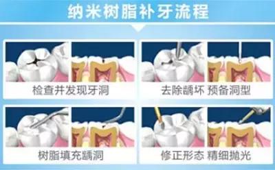 补牙一年后冷水漱口牙痛,补牙之后牙痛是怎么回事