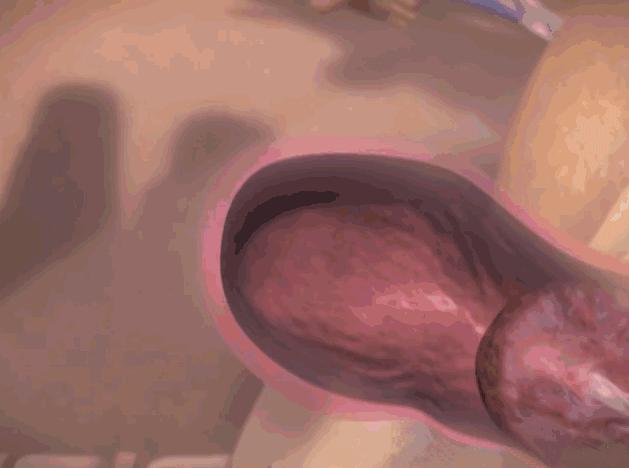 浜轰綋鑳庣洏淇℃伅,浜轰綋鑳庣洏鏄湡鐨勫悧