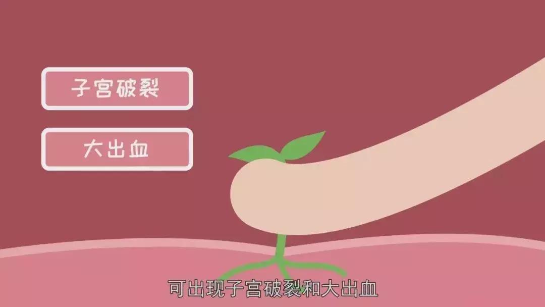 瘢痕妊娠能怀几个月,终于怀上宝宝