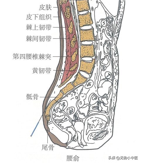 针灸腰部三根大针,针灸治疗腰突三周了