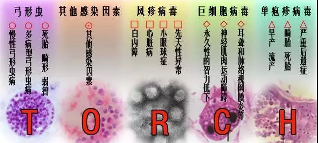 哪些药物可以预防胎儿停育,胎停育的隐形杀手