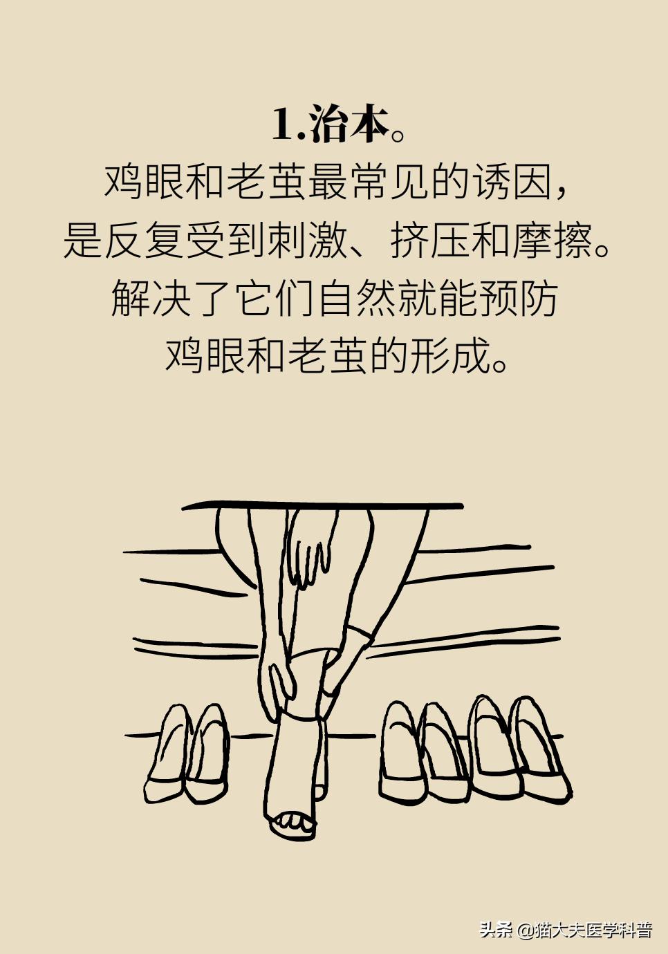 鸡眼好了长了一层老茧,鸡眼与老茧的区别图片