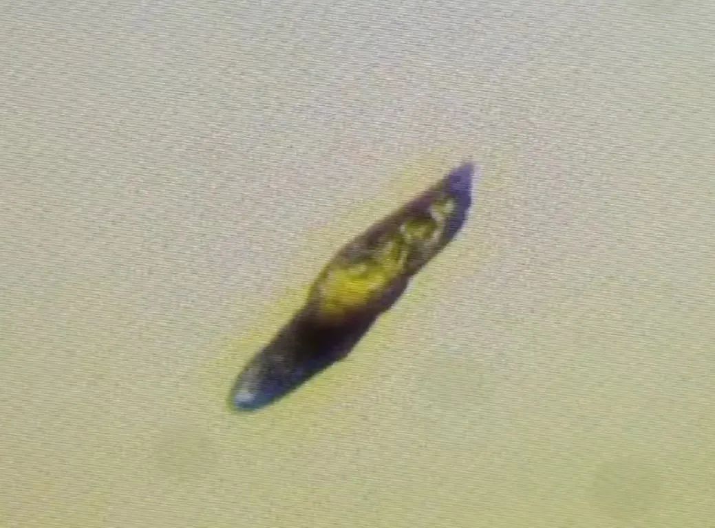 眼睛干涩有螨虫怎么治疗,眼睛干涩痒越揉越痒会不会有螨虫