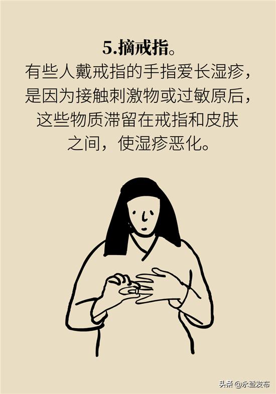 湿疹膏有哪些治疗效果好的,湿疹膏可以治愈吗