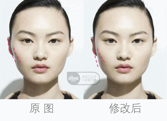 颧弓高脸型怎么改善,有泪沟可以通过调整脸型改善嘛