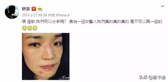 全部皮肤知识大全,四张图让你明白你是什么皮肤