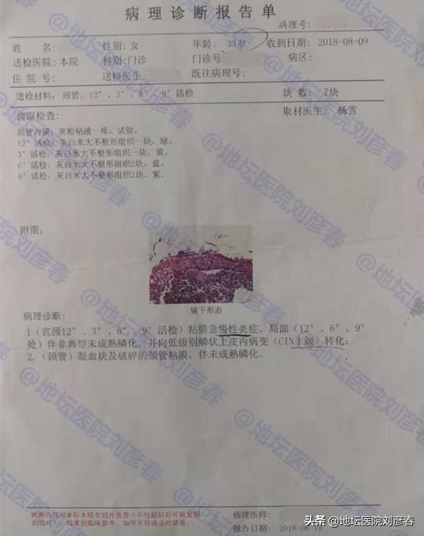 造成hpv持续感染的因素,Hpv感染者早期最明显的症状