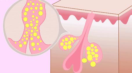 皮肤太黑被人嘲笑怎么办,皮肤暗黄十大救星