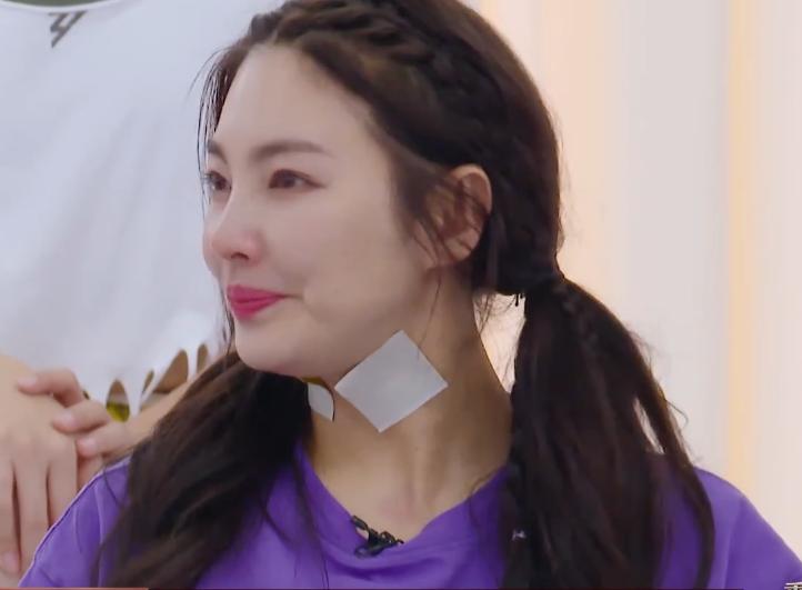 张雨绮腰疼,张雨绮脖子贴的什么