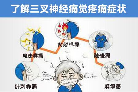 艾灸对三叉神经有作用吗,你们知道三叉苦是治什么病的么