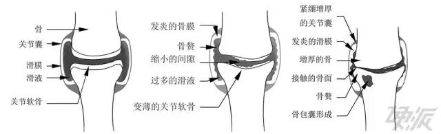 健身教练四个动作缓解膝盖疼痛,健身教练矫正腿型课有用吗
