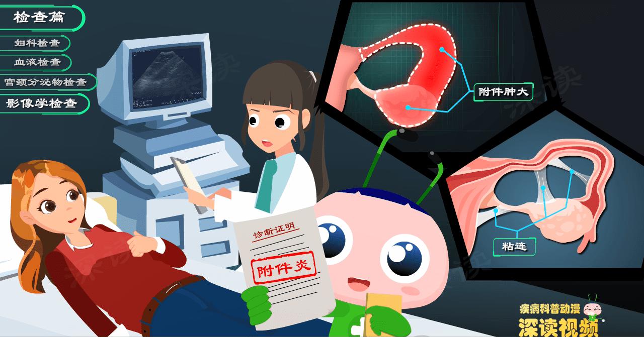 附件炎治疗的有效方法是什么,附件炎要怎么治疗比较好