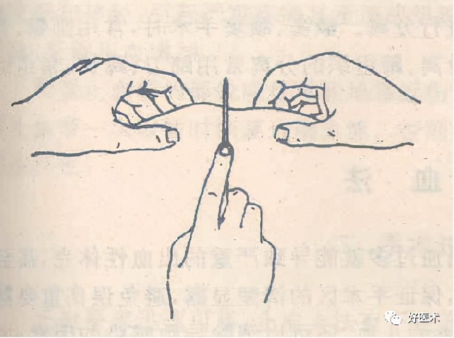 气管切开关注事项,切开引流关注事项
