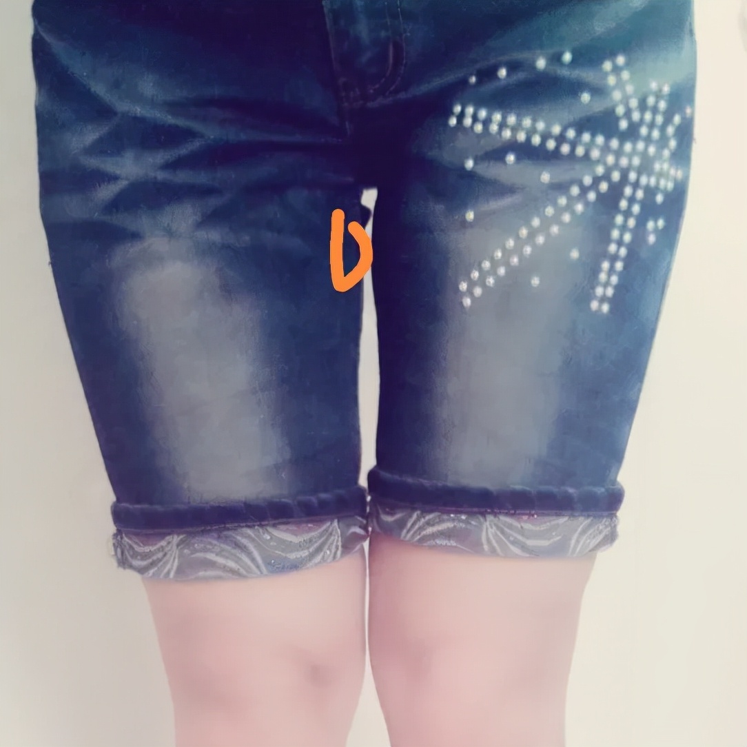 治疗跑调的方法,跑伤的正确处理方法