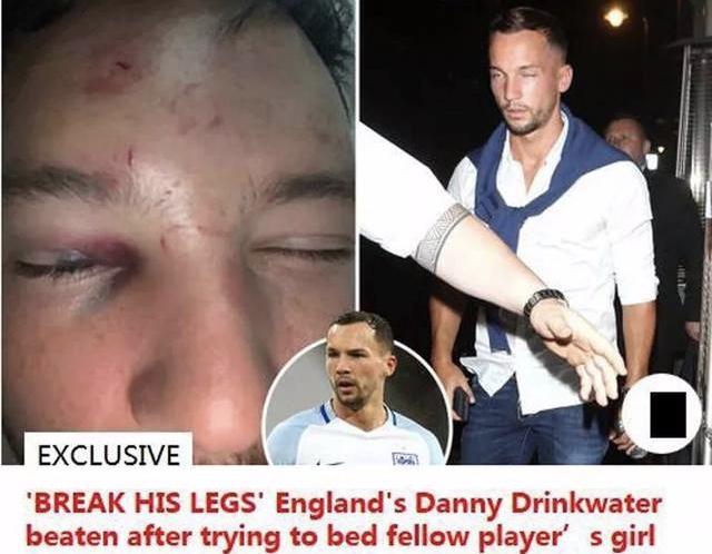 英格兰球员斗殴,英格兰球员打架